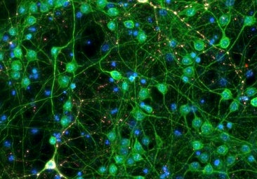 Un estudio explica cómo regenerar las neuronas dañadas