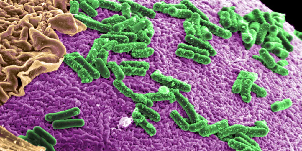 The relationship between intestinal bacteria and disease could be overestimated