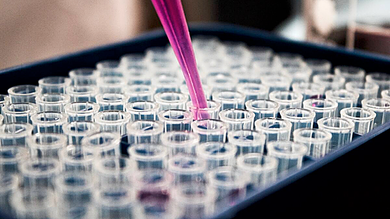 Descubren el talón de Aquiles de las bacterias resistentes a los antibióticos