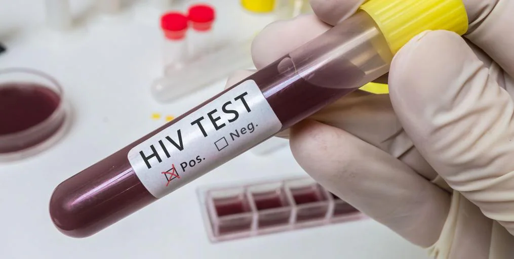 Spain has seen a decline in new HIV diagnoses over the past decade.