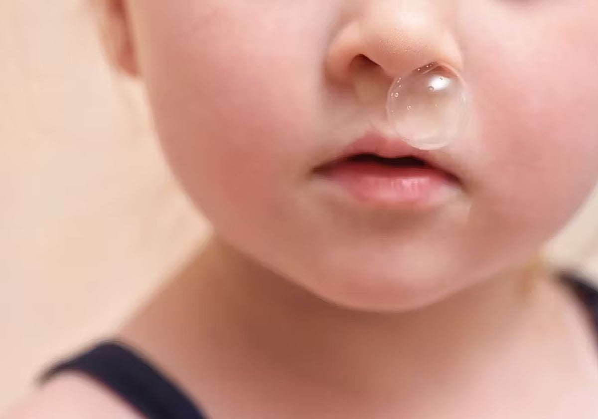 Mocos trasparentes en la cara de una niña