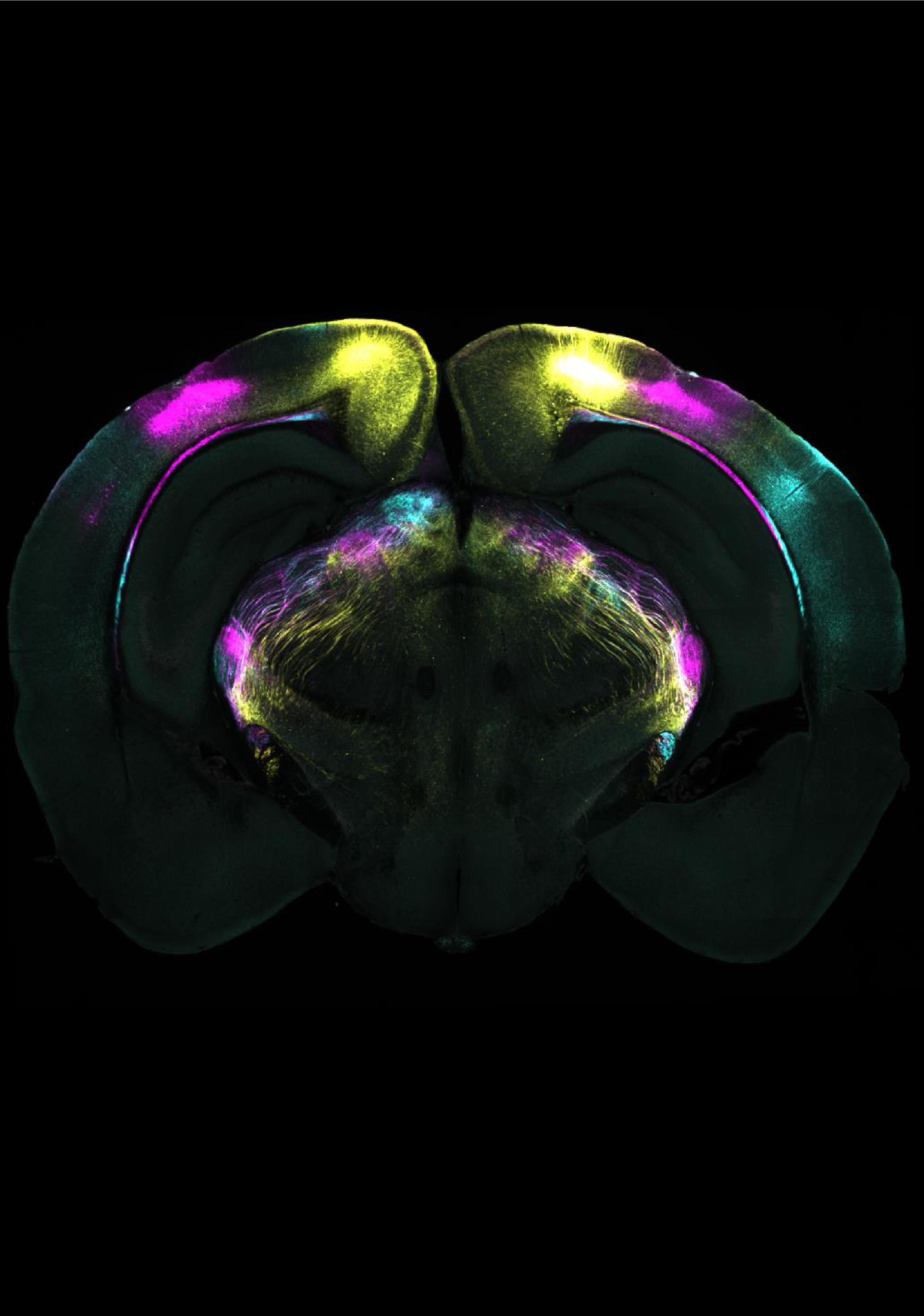 Sección coronaria del cerebro que muestra las proyecciones de diferentes áreas visuales de la corteza cerebral hacia el núcleo geniculado ventrolateral (vLGN). Estas vías forman parte del circuito identificado como mediador de la supresión de las respuestas instintivas de miedo.