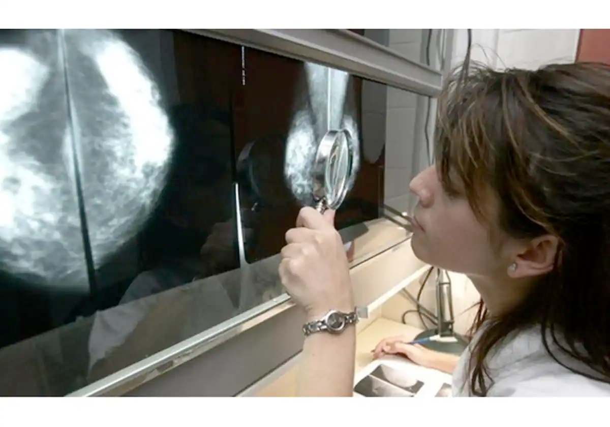 Una profesional sanitaria analiza una mamografía