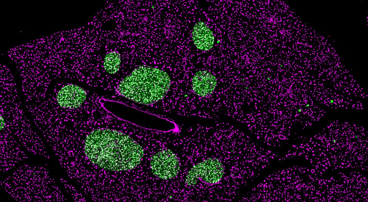 Los investigadores estudiaron el efecto del ayuno intermitente sobre las células beta. En el páncreas de ratones adultos no se observaron efectos negativos sobre las células beta (aquí se muestra en verde).