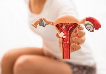 La endometriosis es una enfermedad crónica que afecta a más de 147 millones de mujeres en el mundo