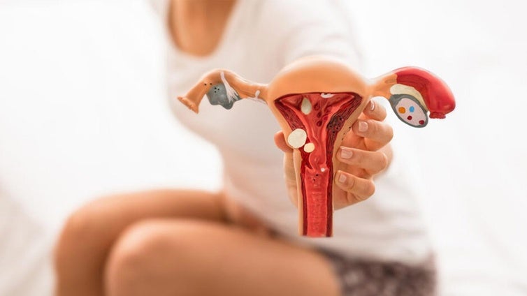 Endometriosis: una emergencia de salud pública