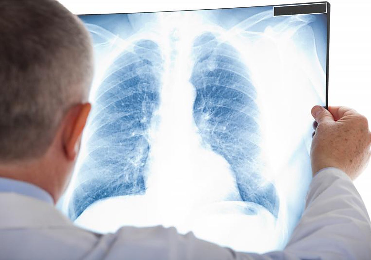 La silicosis ha resurgido en España