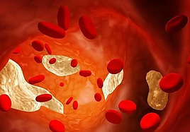 Esta combinación de fármacos puede prevenir miles de infartos