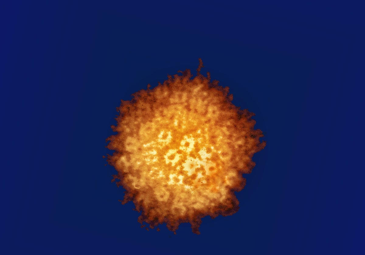 Virus del herpes