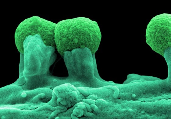 Esta toxina podría estar causando una epidemia de cáncer colorrectal en jóvenes