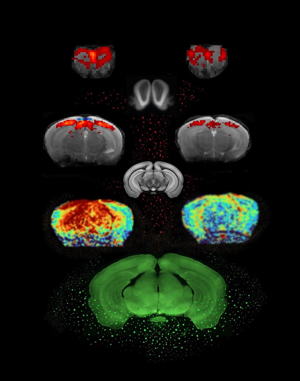 Actividad neuronal en los cerebros de ratones control (izquierda) y ratones con EP (derecha)