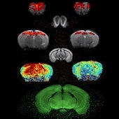 Actividad neuronal en los cerebros de ratones control (izquierda) y ratones con EP (derecha)