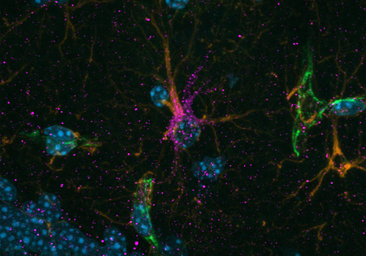 Estas neuronas del cerebro se benefician del ejercicio y ayudan a frenar el alzhéimer