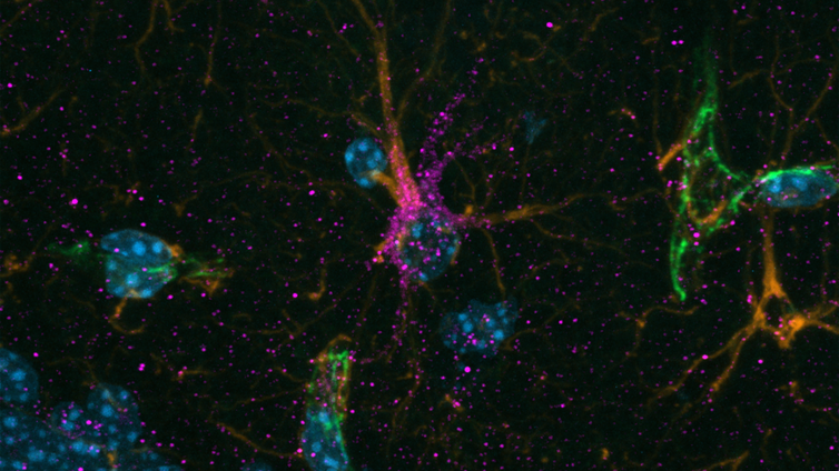 Estas neuronas del cerebro se benefician del ejercicio y ayudan a frenar el alzhéimer