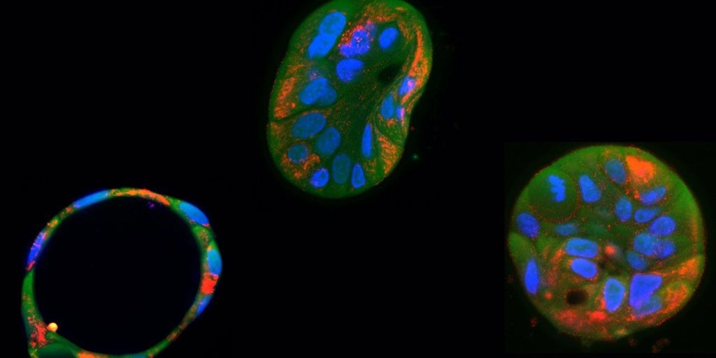科学者は、遺伝版を使用してミトコンドリアDNAの有害な変異を修正することができます