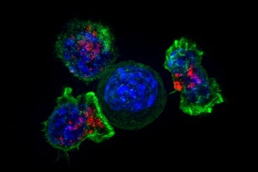 Un nuevo tratamiento frena el cáncer de próstata resistente en un 35%