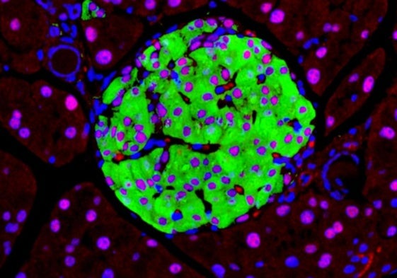 Células pancreáticas