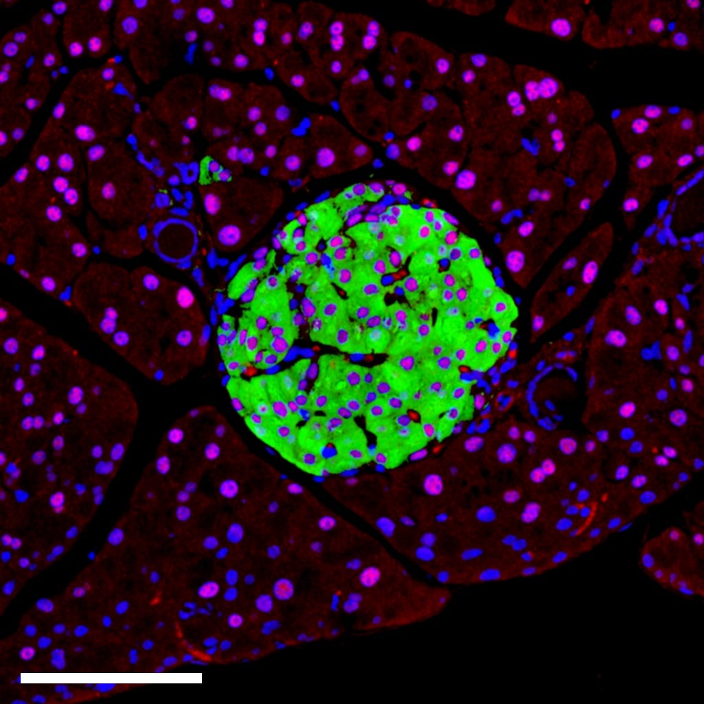 Células pancreáticas