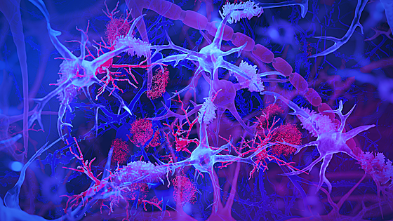 Meliterapia: engrasar el cerebro para curar enfermedades neurológicas complejas