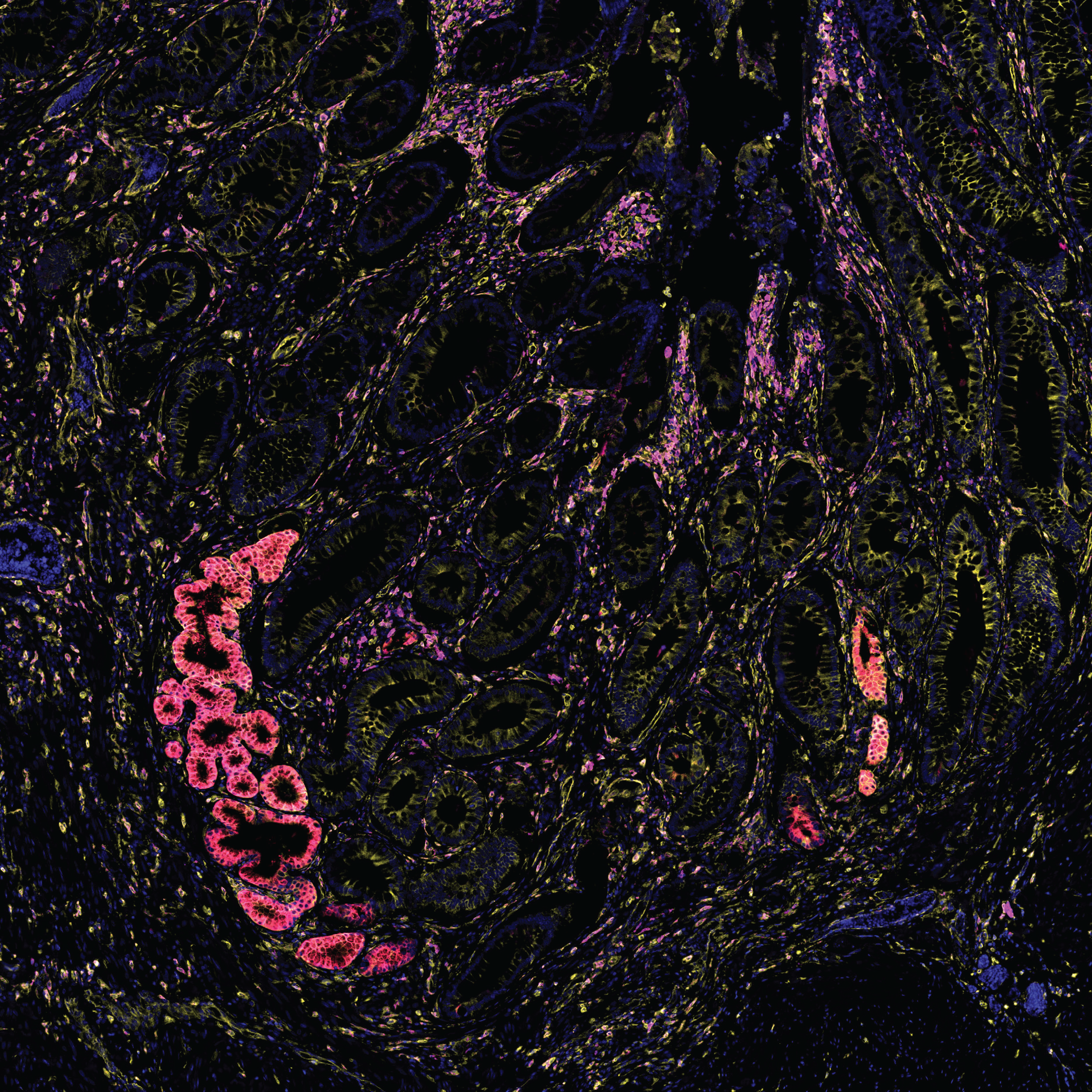 Bacterias intestinales