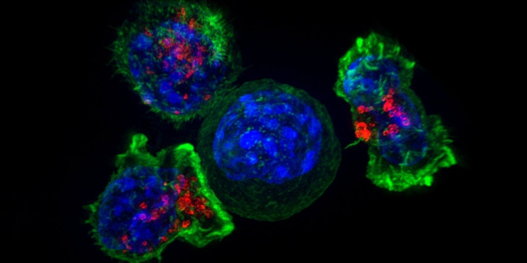 Así se escapa el cáncer de pulmón de los tratamientos