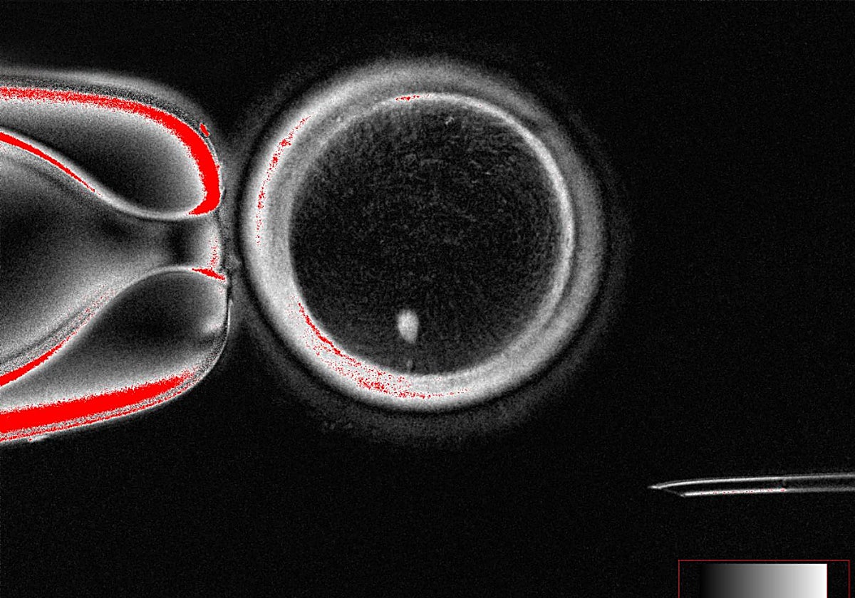 Ovocito humano SCNT con huso visible (punto brillante en el interior) antes de la fecundación.