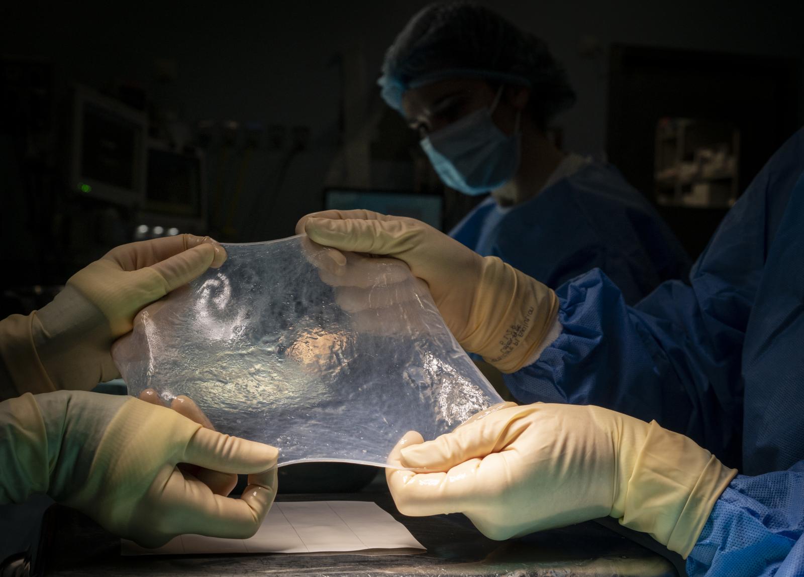 Cirugía para un trasplante