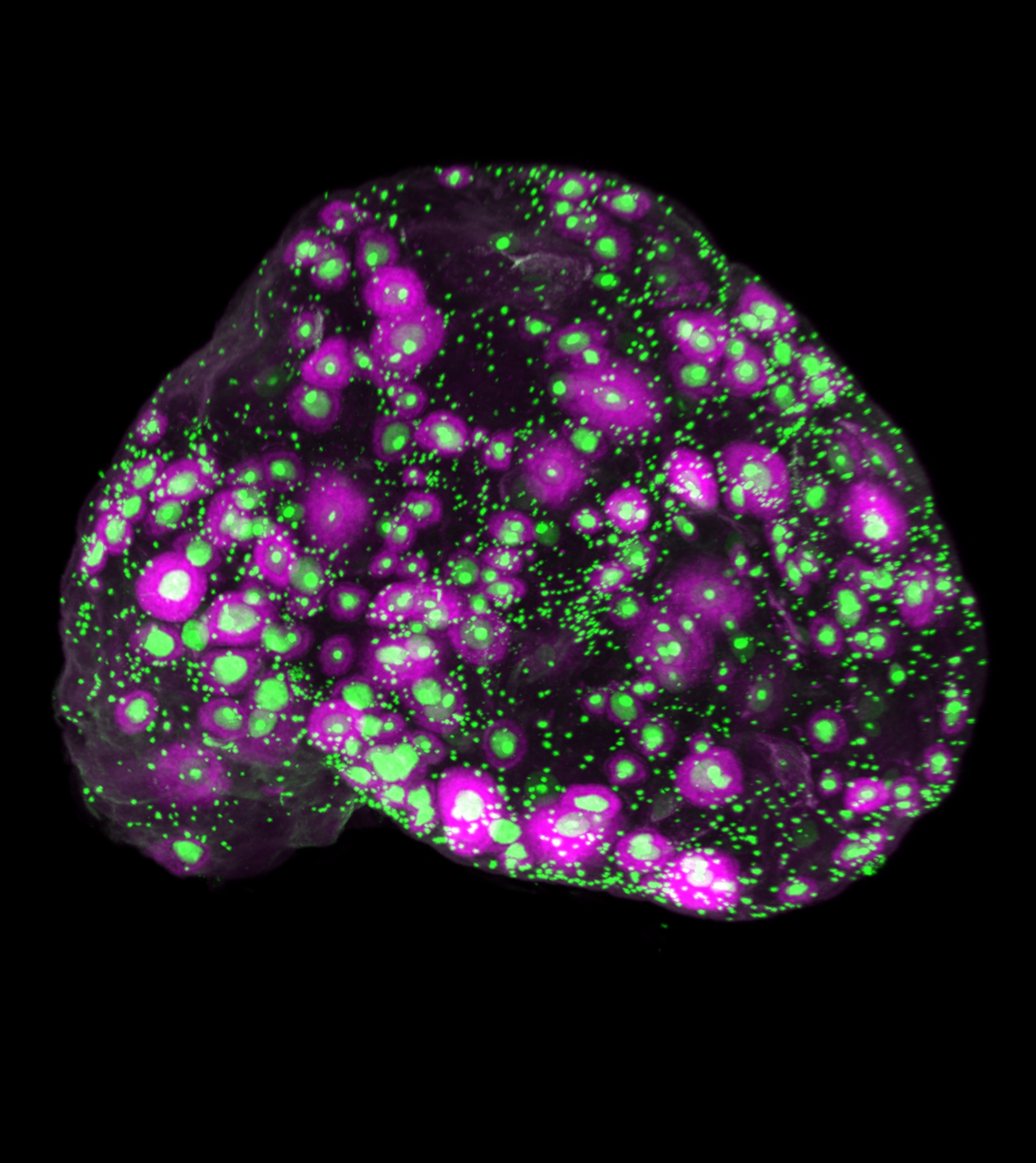 La imagen muestra la disminución relacionada con la edad en el número total de óvulos (verde) y en el subconjunto de óvulos en crecimiento (magenta), cuantificada en todo el ovario