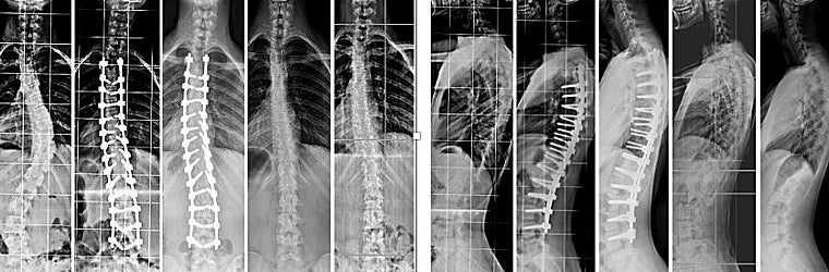 Figuras de un caso tratado con la técnica GVPM