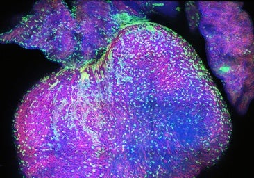 Formación de la vasculatura coronaria en un corazón de ratón