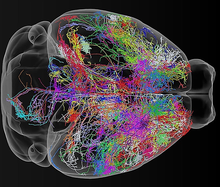El atlas más detallado del cerebro revela cuándo y cómo surgen enfermedades como el autismo o la esquizofrenia