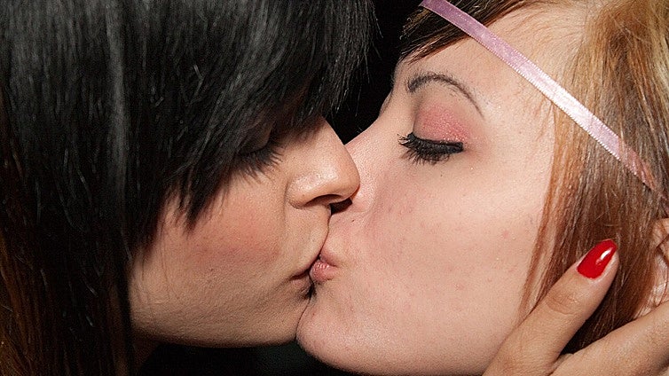 El virus del beso es el responsable de la enfermedad de lupus