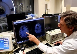 Una terapia de ultrasonidos mejora la supervivencia en un agresivo cáncer cerebral