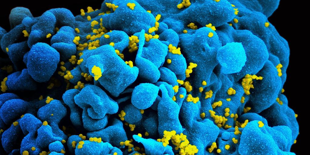 免疫療法により、薬を使わずに 7 人の HIV が数か月間抑制される