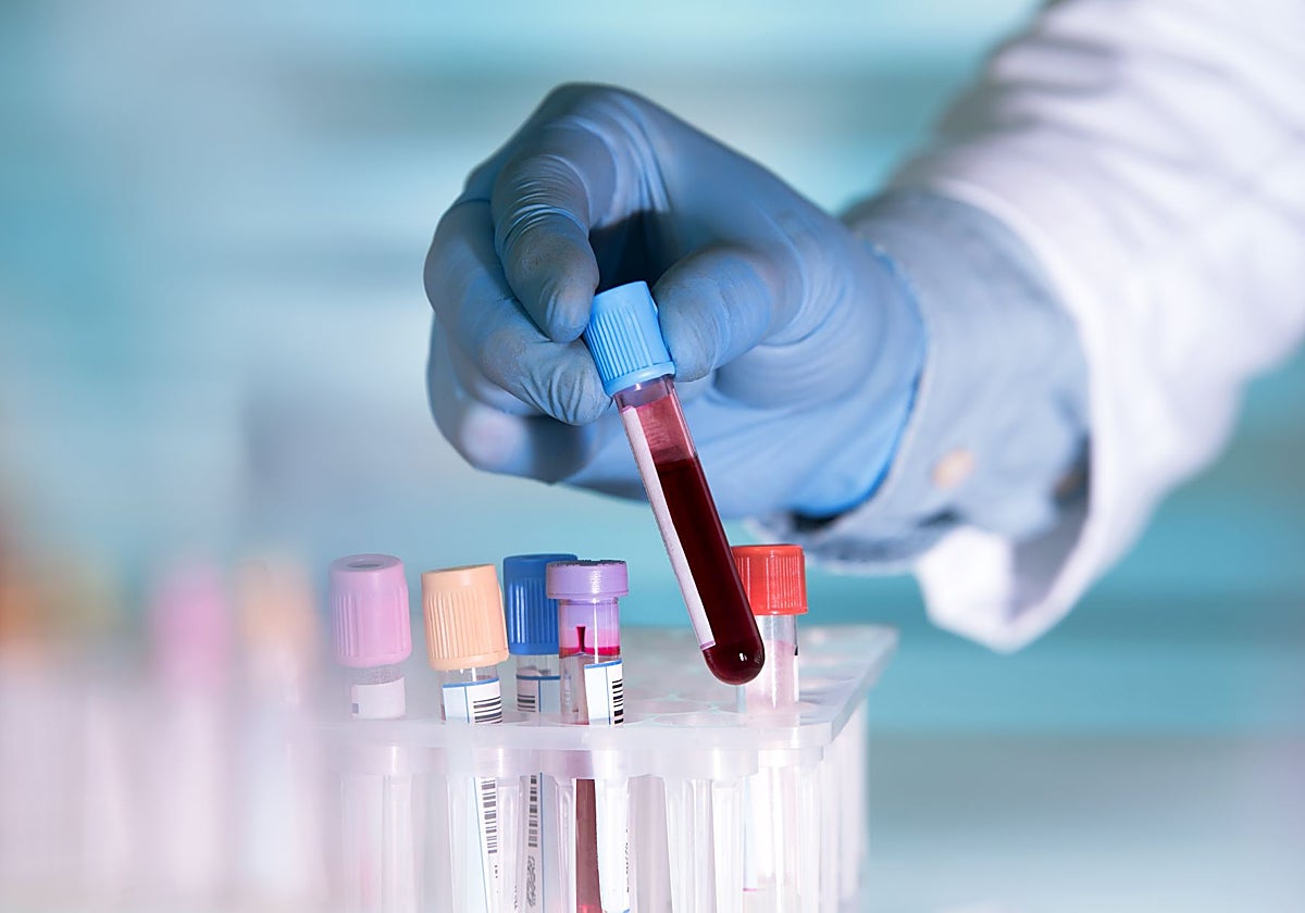 El mieloma múltiple es un cáncer hematológico