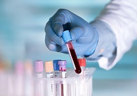 Una nueva terapia con anticuerpos erradica el mieloma múltiple en 18 pacientes