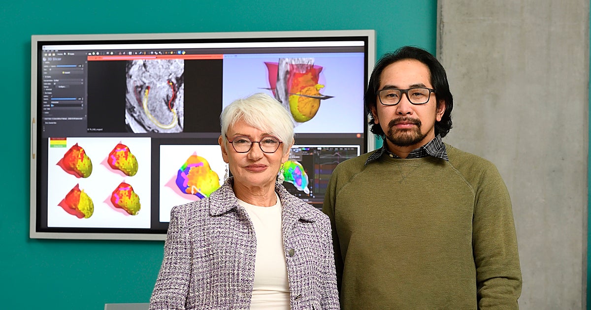 Logran un 100% de éxito contra las arritmias con un 'gemelo digital' del corazón