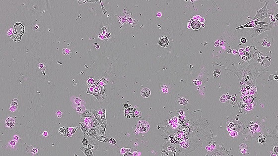 De bisturí genético a trituradora de células: este nuevo CRISPR «aniquila» el cáncer