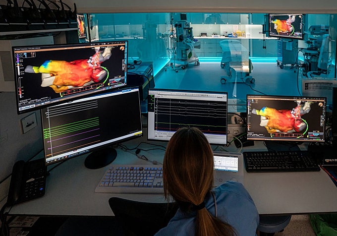 La sala Zero de la Unidad de Arritmias permite visualizar el corazón en 3D y realizar procedimientos guiados sin exponer a pacientes ni médicos a radiación