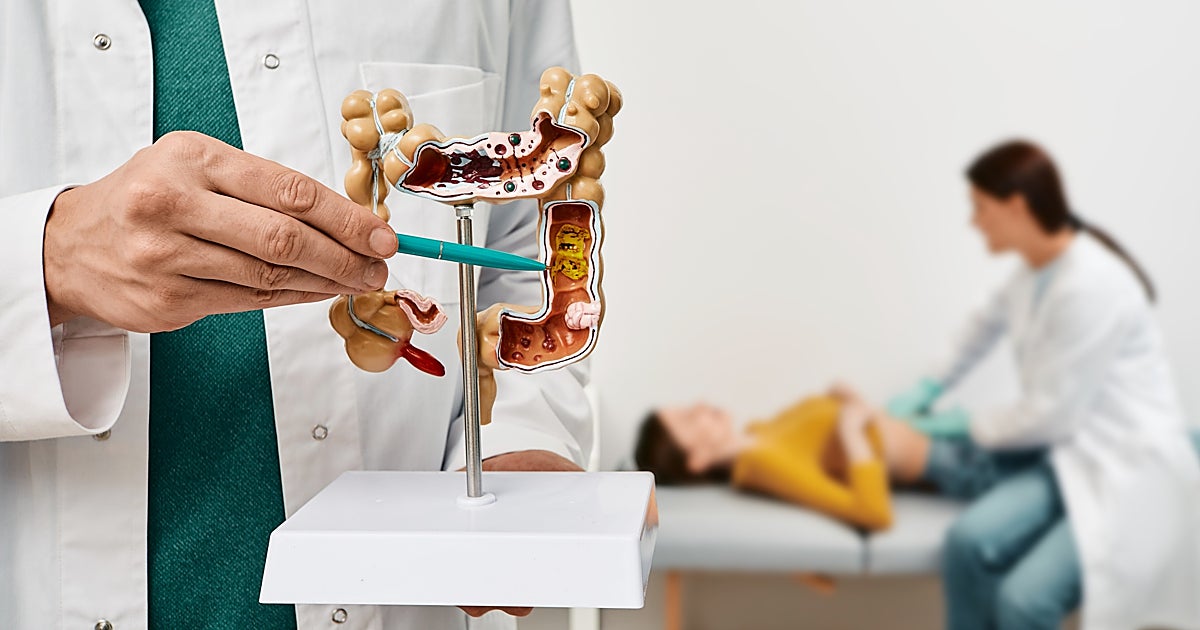 Investigadores españoles descubren cuál es el tratamiento más eficaz para  el cáncer de colon metastásico