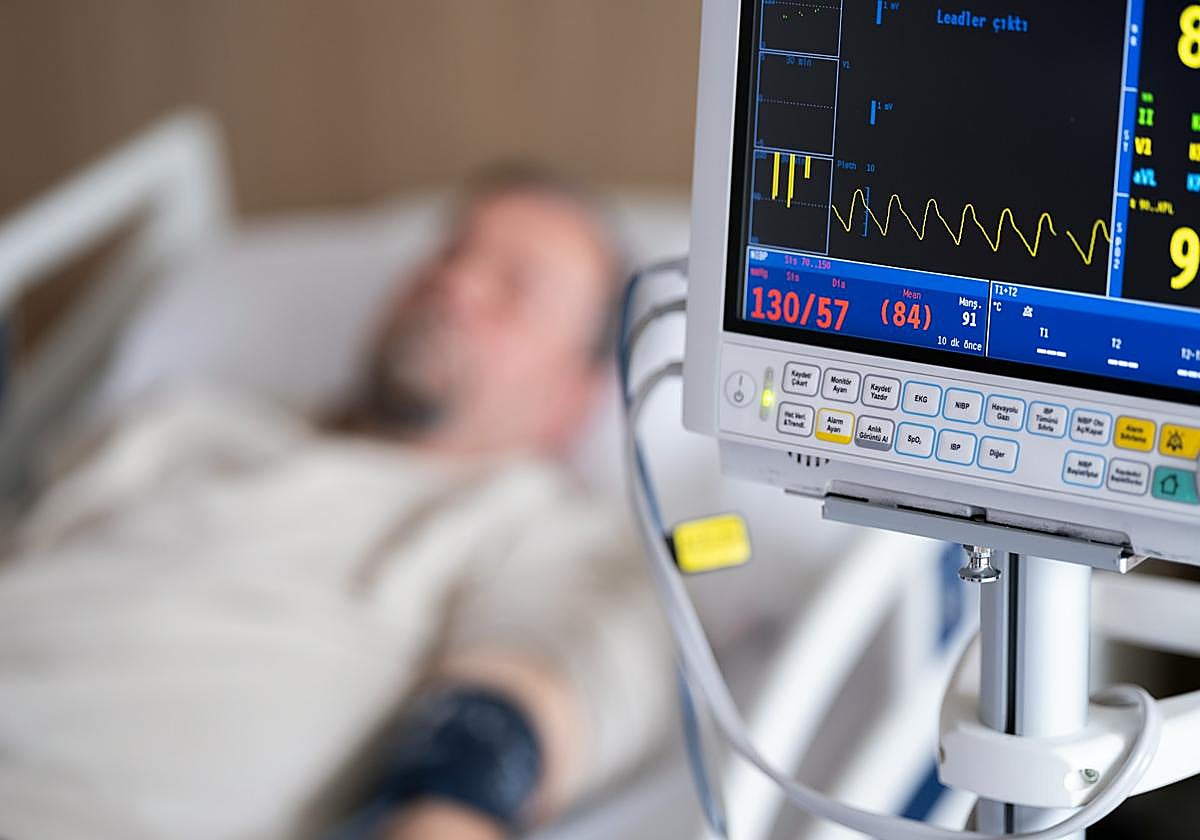 Los pacientes que sufren un infarto tienen más microplásticos en la sangre del corazón