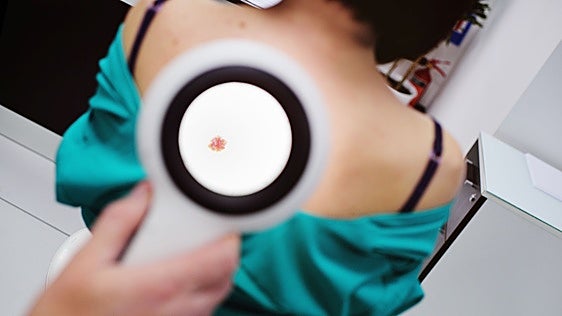 Lo que aún no sabemos de la vacuna que quiere revolucionar el tratamiento del cáncer