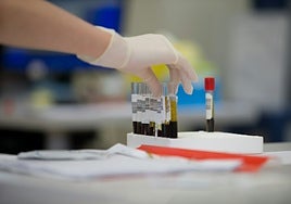 Una nueva forma de buscar cáncer en la sangre, incluso en análisis que parecen «normales»