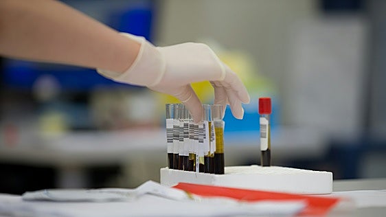 Una nueva forma de buscar cáncer en la sangre, incluso en análisis que parecen «normales»