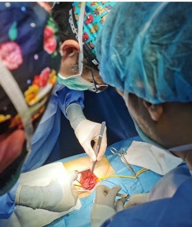 Imagen secundaria 2 - El proceso de estos implantes arranca en el laboratorio y las salas blancas donde se fabrican las venas personalizadas y continúa en el quirófano, donde vemos en acción al doctor García León y a su equipo del Hospital Universitario de Valme en distintas fases de procedimiento