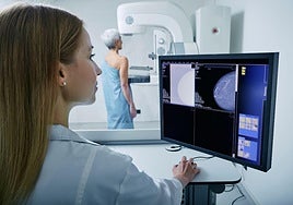 Quirónsalud ofrecerá mamografías gratis durante este viernes en este hospital de Sevilla