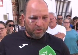 La paliza a un hombre desata la indignación en Villaverde del Río: «No son inmigrantes, son maleantes»