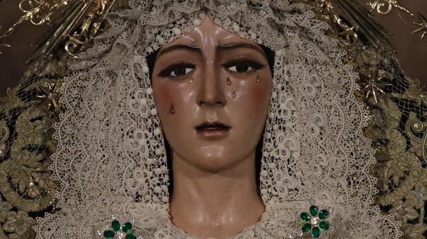 Imagen después - Comparativa del rostro de la Macarena antes y después de la intervención