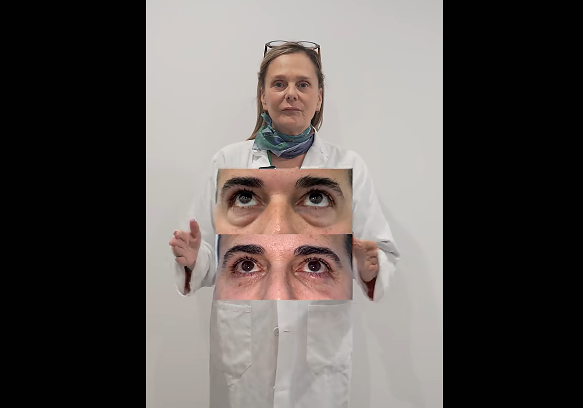 Ana Vázquez, oftalmóloga del Hospital Centro de Andalucía, muestra el antes y después de una blefaroplastia