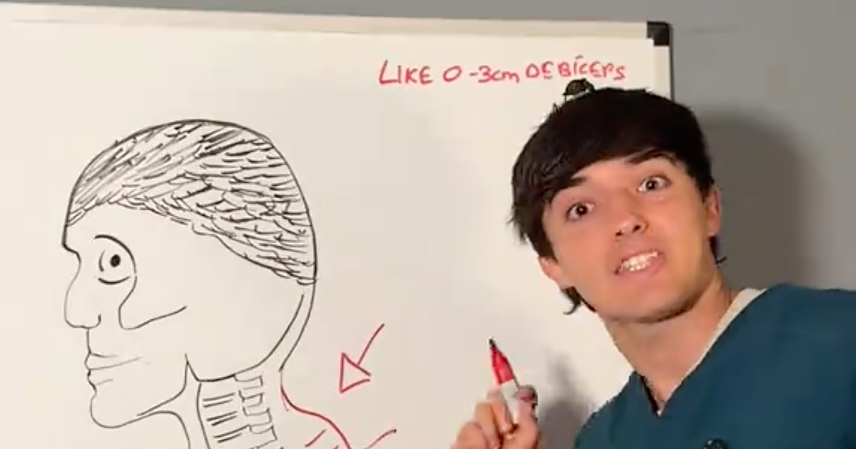 Un fisioterapeuta explica por qué los costaleros tienen 'morrillo': «El hueso crece de forma anormal»